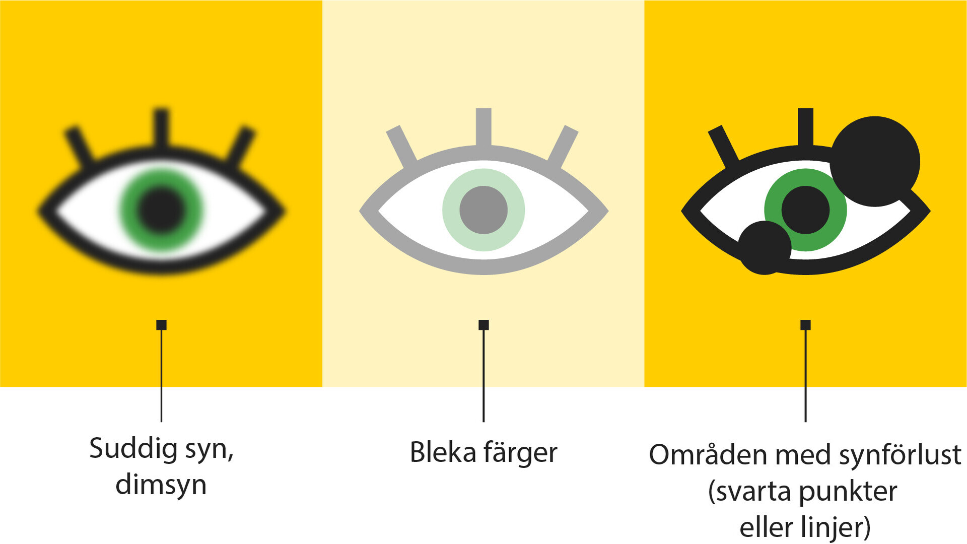 Illustration av olika synfel