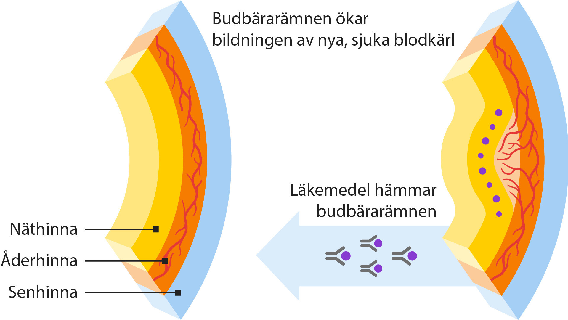 Illustration som visar hur läkemedel hämmar budbärarämnen i ögat